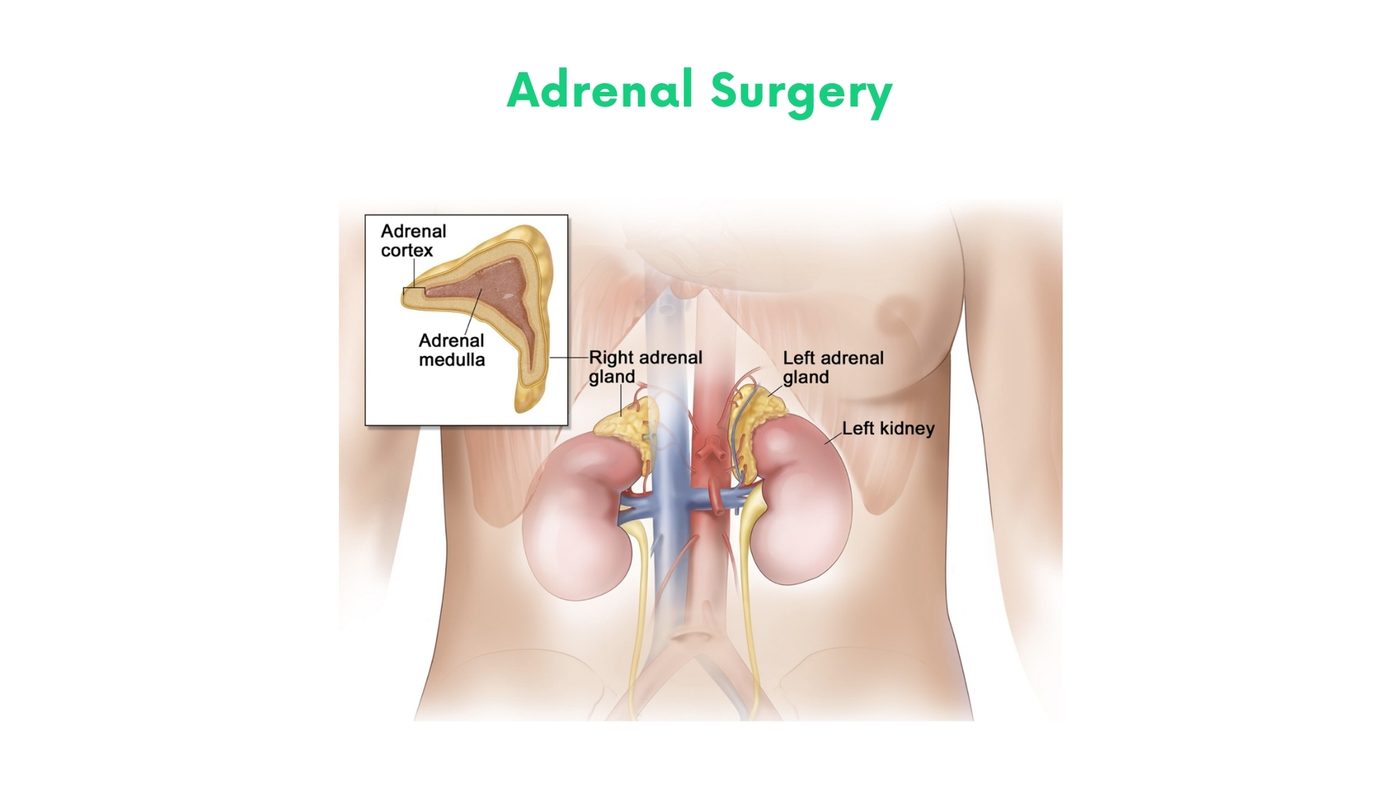 Adrenal Surgery by Dr. Shehryar Niazi