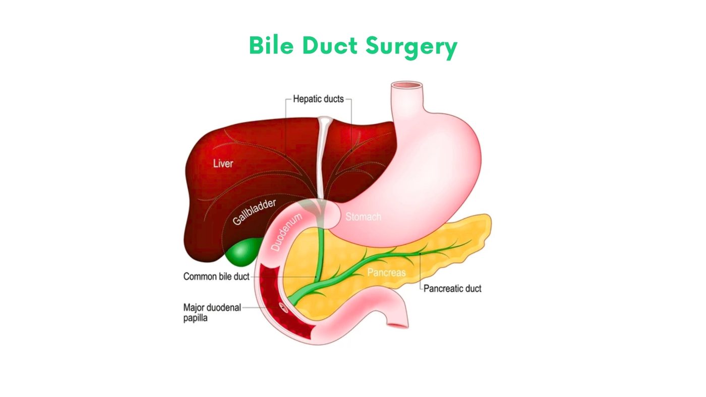Bile Duct Surgery by Dr. Shehryar Niazi