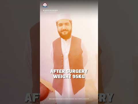 Weight loss surgery patient testimonial for Dr. Shehryar Niazi